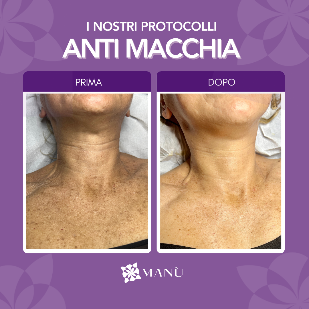 TRATTAMENTO ANTIMACCHIA CAGLIARI