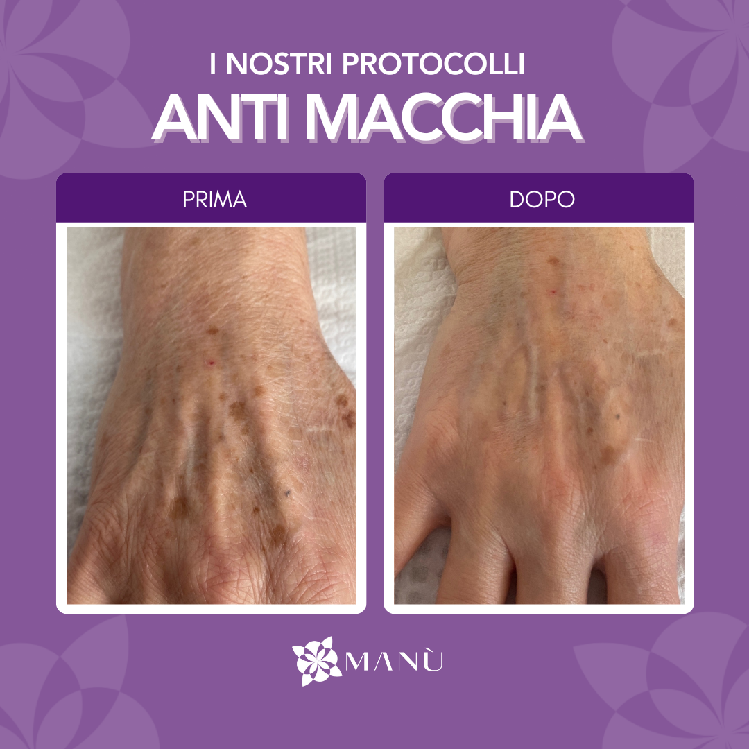 TRATTAMENTO ANTIMACCHIA CAGLIARI