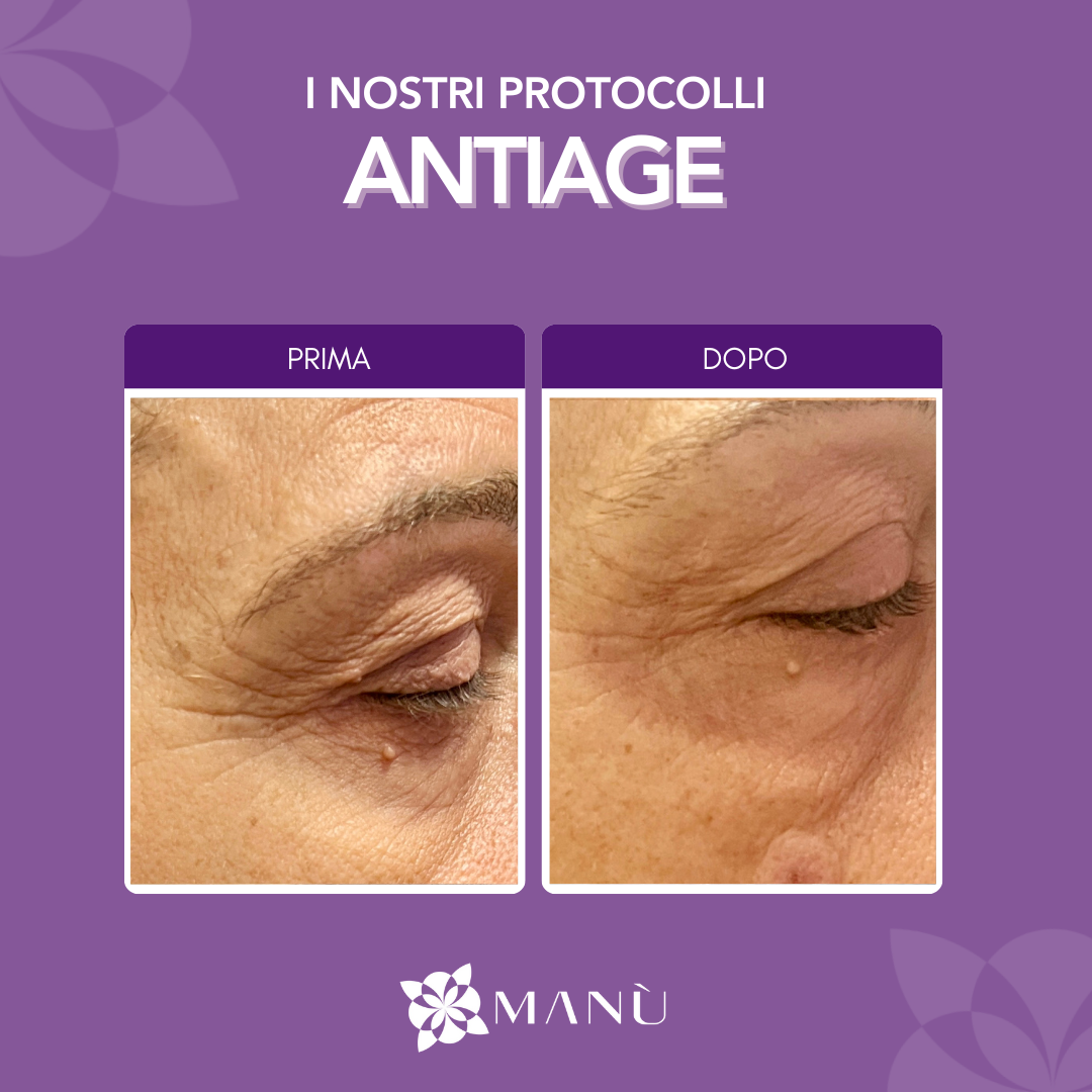 TRATTAMENTO ANTI AGE CAGLIAR