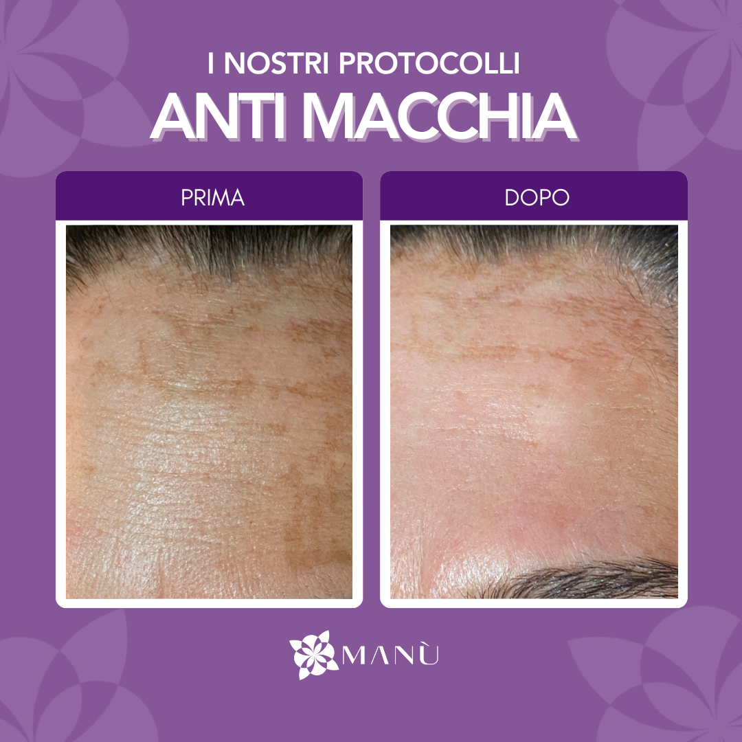 TRATTAMENTO ANTIMACCHIA CAGLIARI