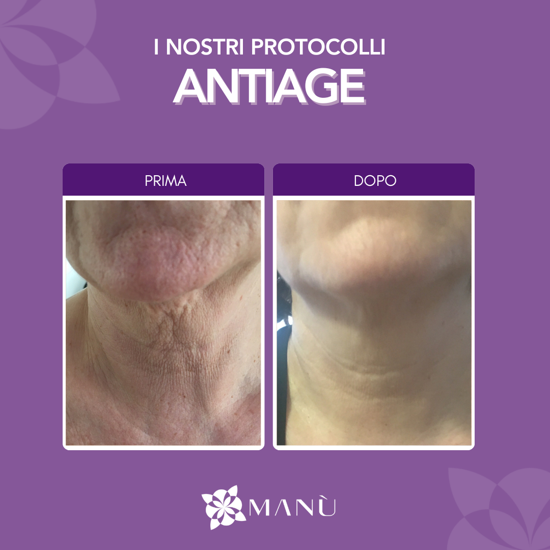 TRATTAMENTO ANTI AGE CAGLIAR