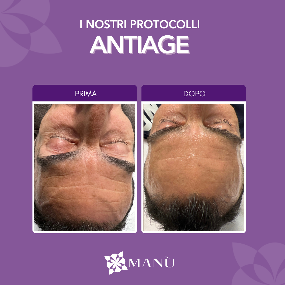 TRATTAMENTO ANTI AGE CAGLIAR
