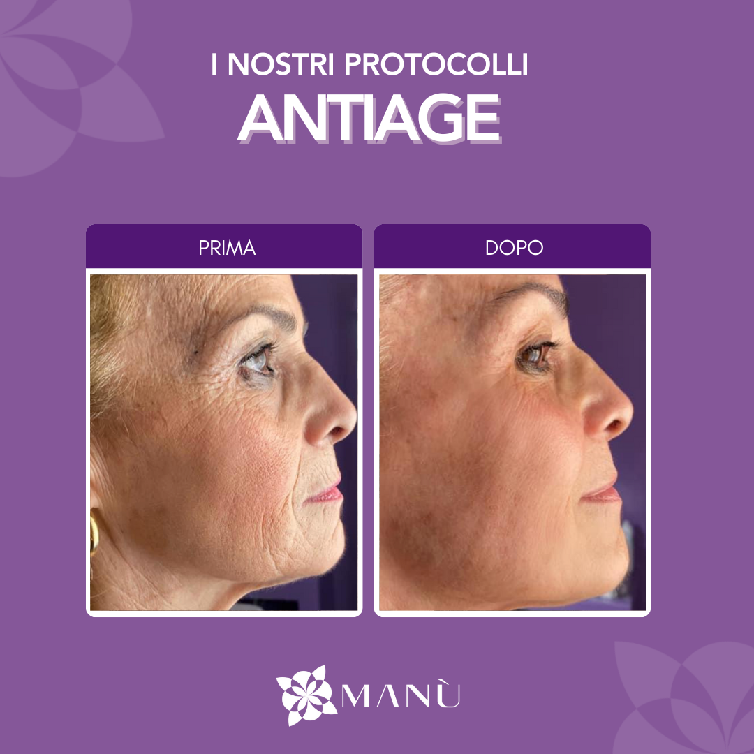 TRATTAMENTO ANTI AGE CAGLIAR